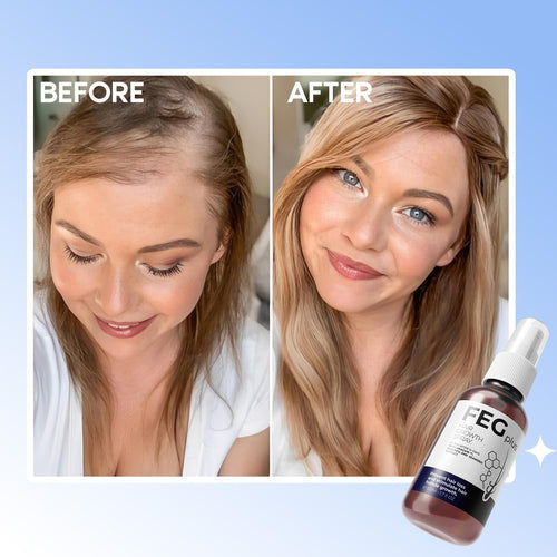 FEG Hair Growth Spray - 100% Original